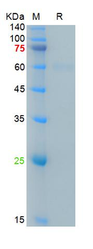 SARS-Cov-2 Spike RBD Protein