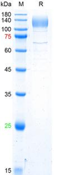 SARS-Cov-2 Spike S1 Protein