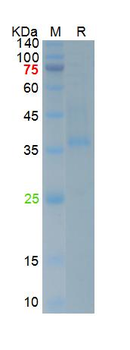 SARS-Cov-2 Spike RBD Protein