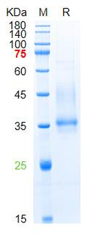 SARS-Cov-2 Spike RBD Protein