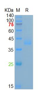 Human Azurocidin Protein