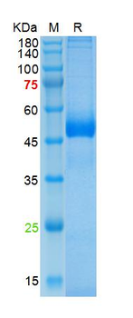 Human Azurocidin Protein