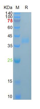 Human Azurocidin Protein