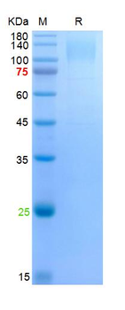 SARS-Cov-2 Spike S1 Protein