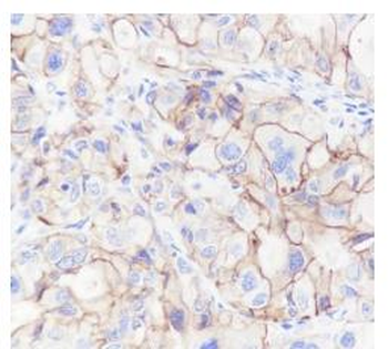 CD47 antibody