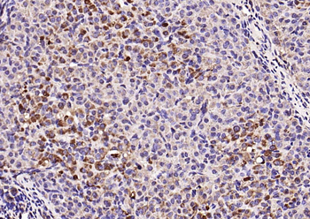 c-Kit antibody