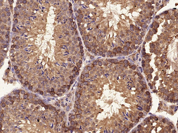 c-Kit antibody