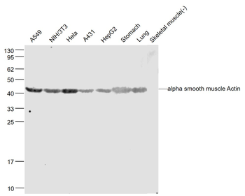 ACTA2 antibody