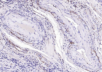 ACTA2 antibody