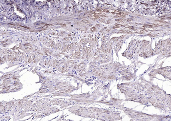 ACTA2 antibody