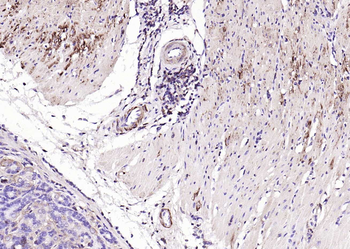 ACTA2 antibody