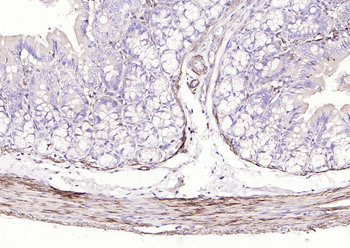 ACTA2 antibody