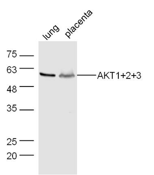 AKT+2+3 antibody