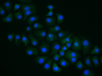 Arginase II antibody