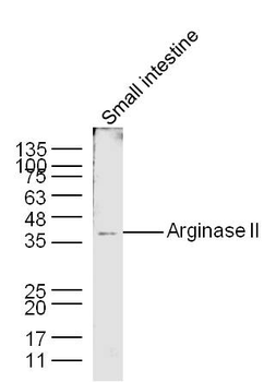 Arginase II antibody