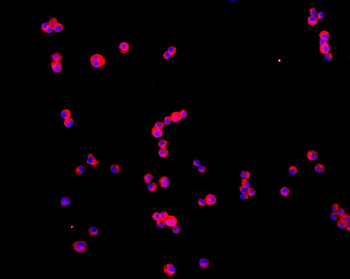 Arginase II antibody