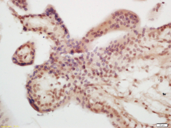 ASCL2 antibody