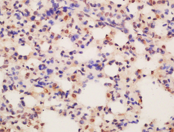 ASCL2 antibody