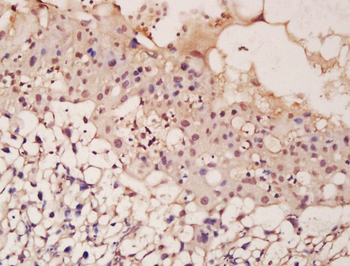 ASCL2 antibody