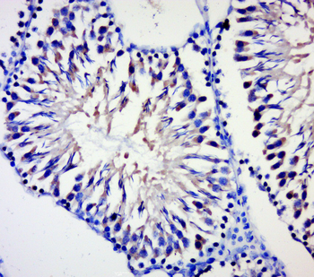 BPTF antibody