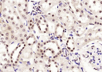 BPTF antibody