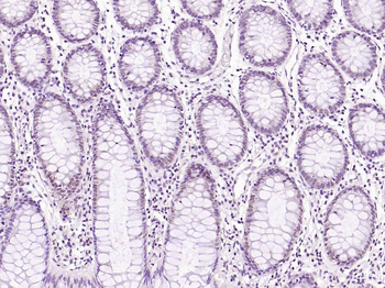 B-Raf (Phospho Ser729 antibody