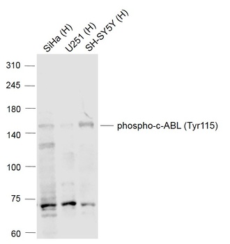 c-ABL(Phospho-Tyr115) antibody