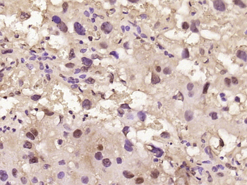 Phospho-CK18 (Ser52) Rabbit Polyclonal Antibody