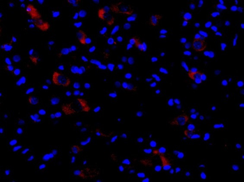 Cryopyrin antibody