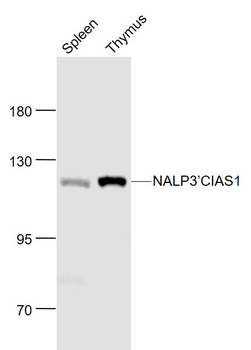 Cryopyrin antibody