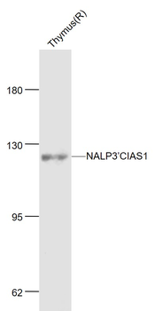 Cryopyrin antibody