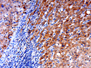 CYP11A1 antibody