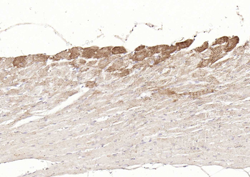 DLST antibody