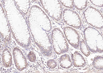 E cadherin antibody