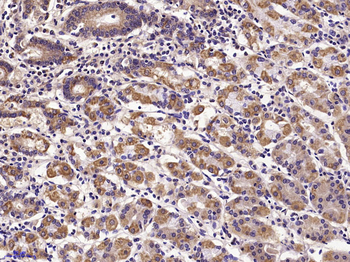 E cadherin antibody