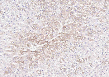 E cadherin antibody