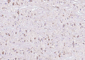 E cadherin antibody