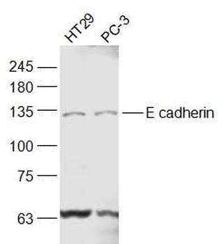 E cadherin antibody