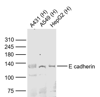 E cadherin antibody