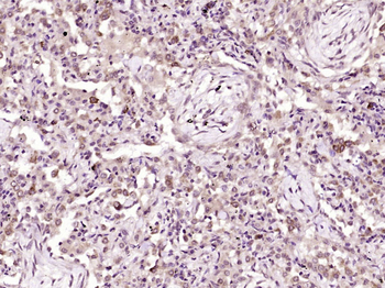 FbxL4 Rabbit Polyclonal Antibody