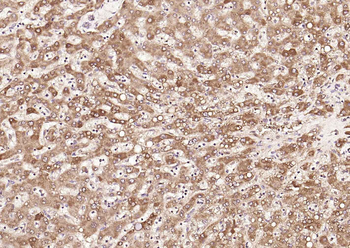 FDPS antibody