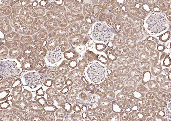 FDPS antibody