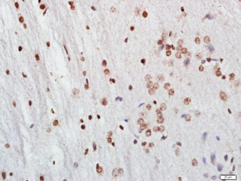 FoxP3 antibody