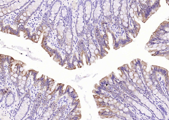 Pan Cytokeratin Antibody