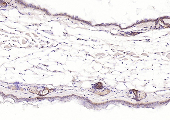 Pan Cytokeratin Antibody