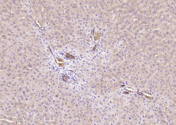 Pan Cytokeratin Antibody