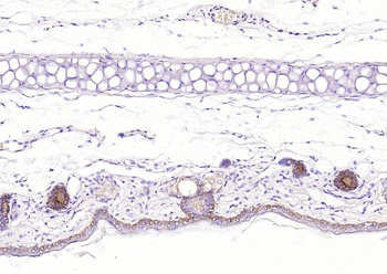 Pan Cytokeratin Antibody