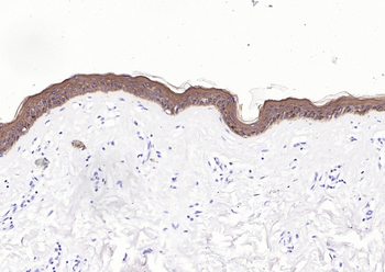 Pan Cytokeratin Antibody