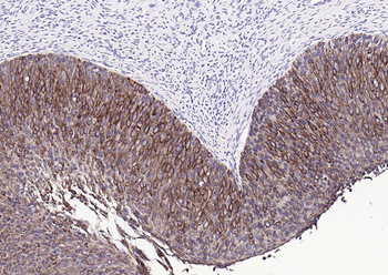 Pan Cytokeratin Antibody