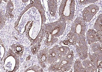 Pan Cytokeratin Antibody